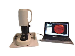 I-OPTICS EasyScan Retinal Imagining SLO Digital Fundus Camera